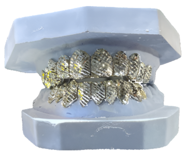 Silver Diamond Cut Grillz