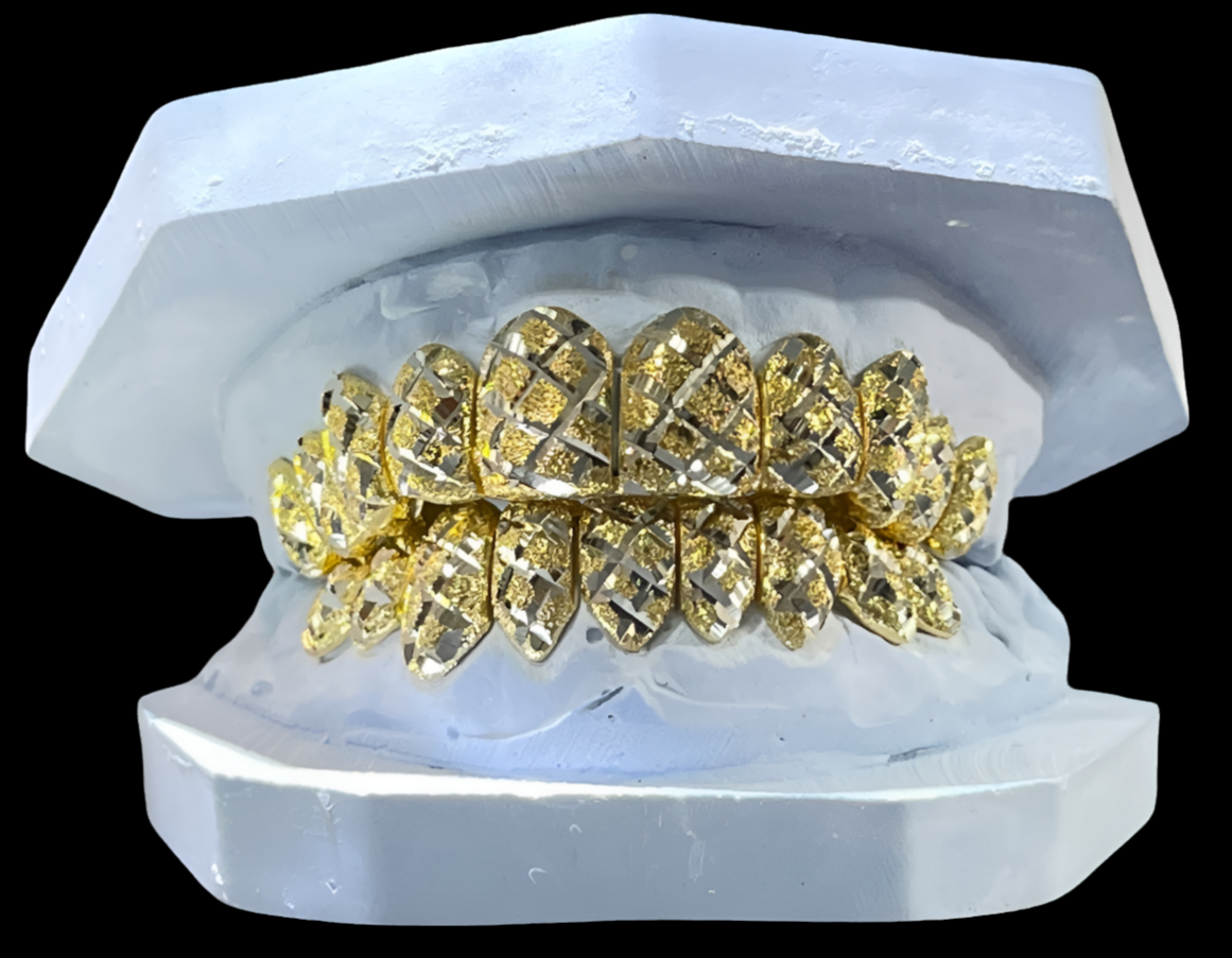 10K Yellow Dust & White Cut Two Tone Grillz