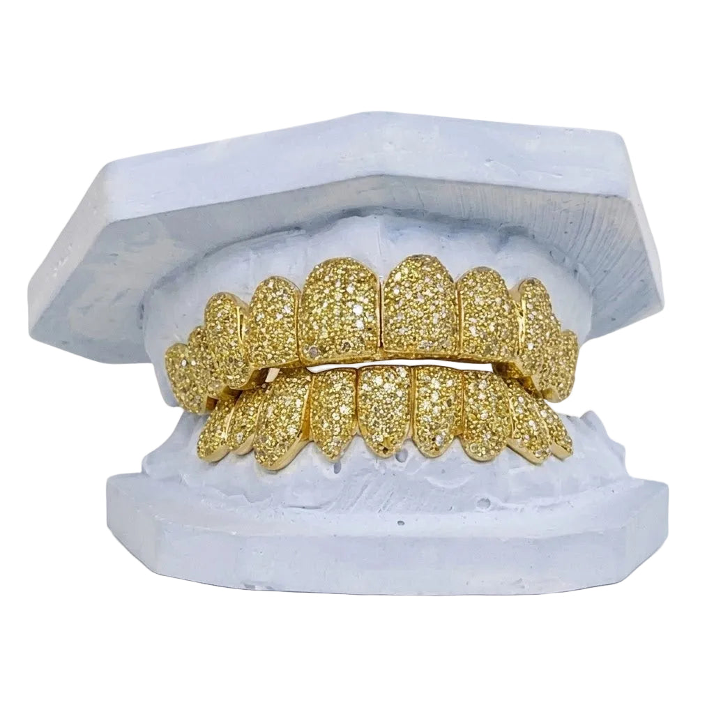 Yellow Canary Zig-Zag Diamond Grillz