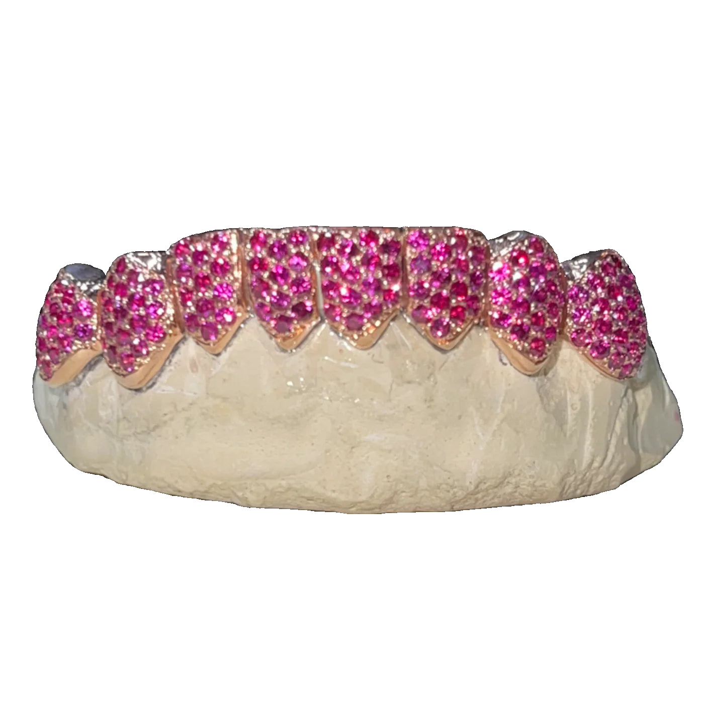 Custom Gemstone Grillz