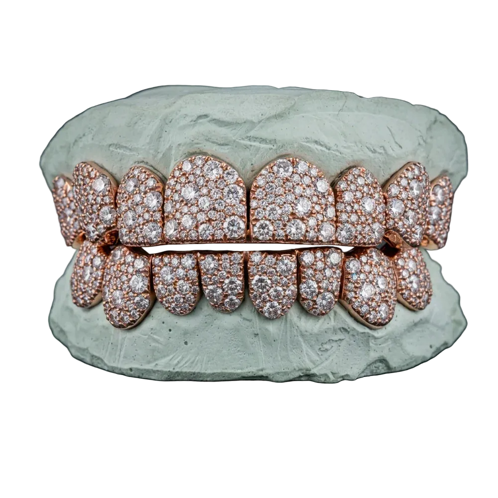 OV Galaxy Grillz