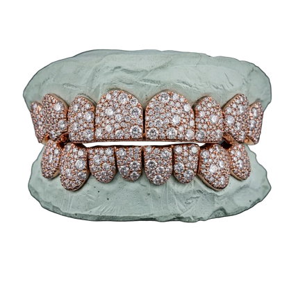 OV Galaxy Grillz
