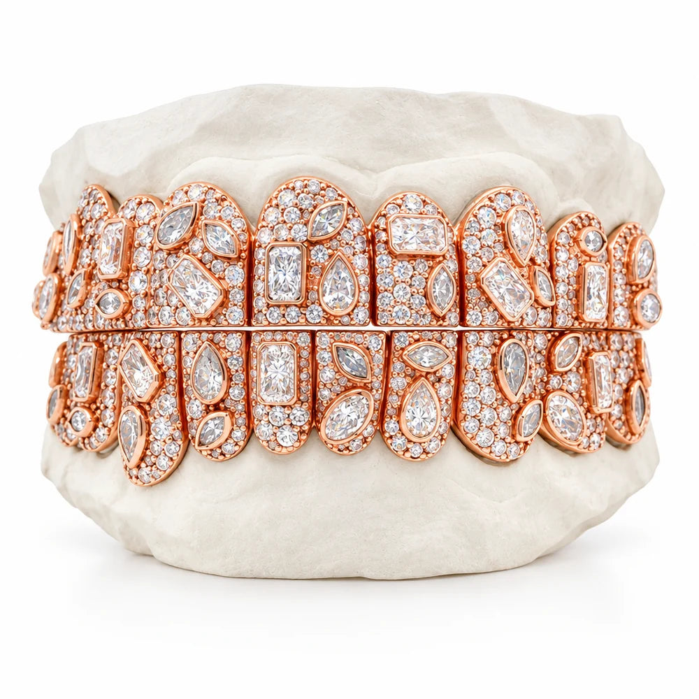 OV Moon Grillz