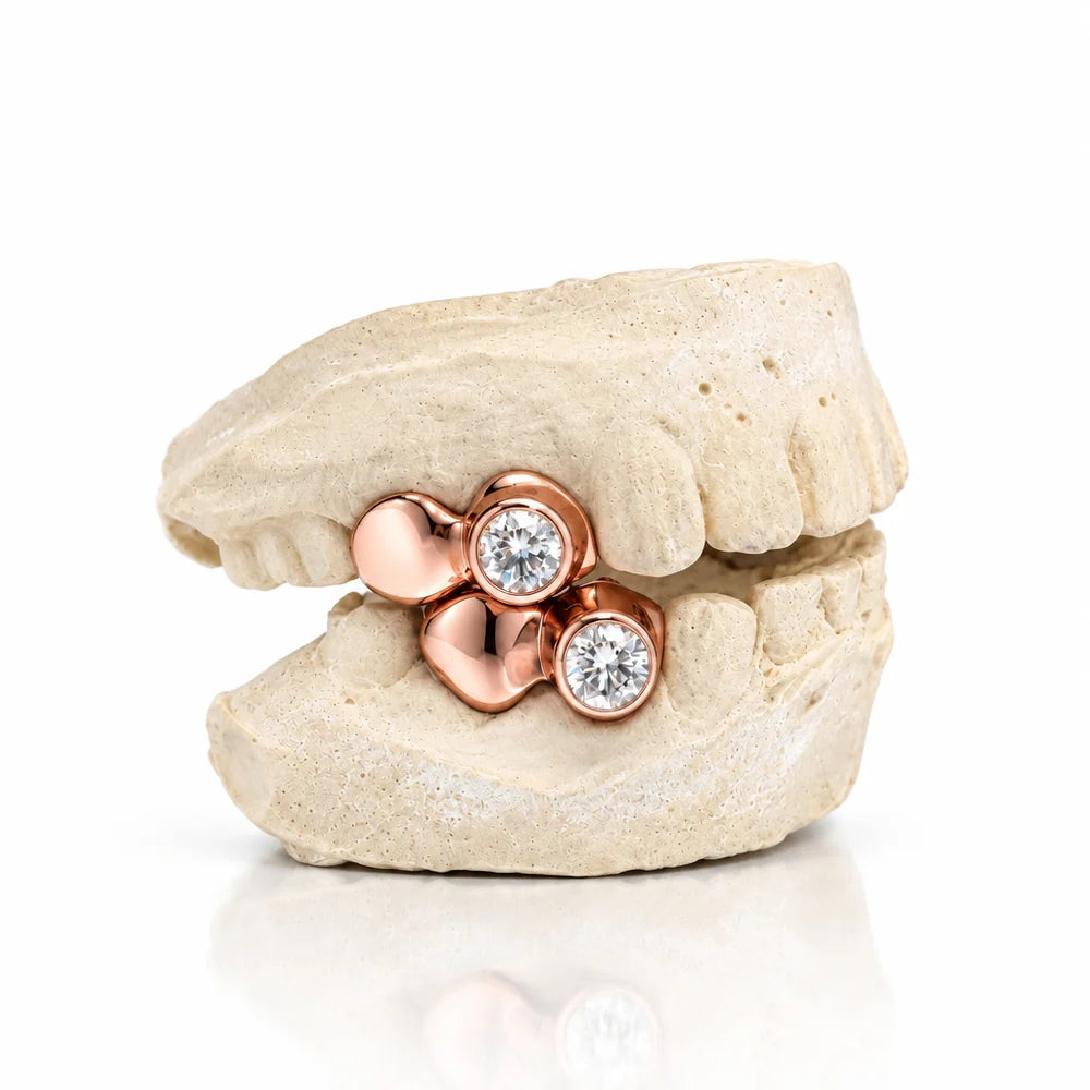 OV Single Stone Dubccap Grillz
