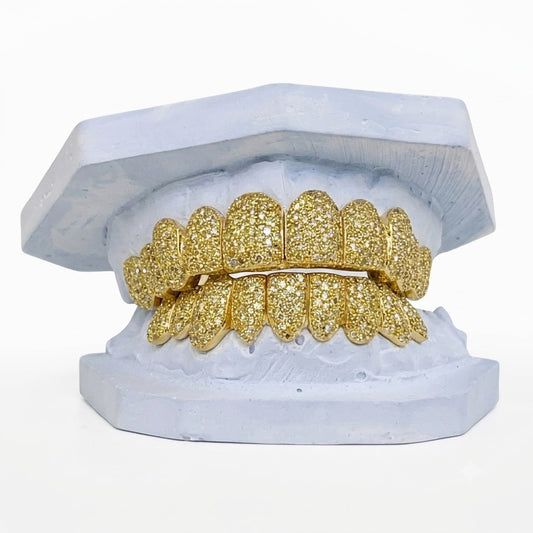 Yellow Canary Zig-Zag Diamond Grillz