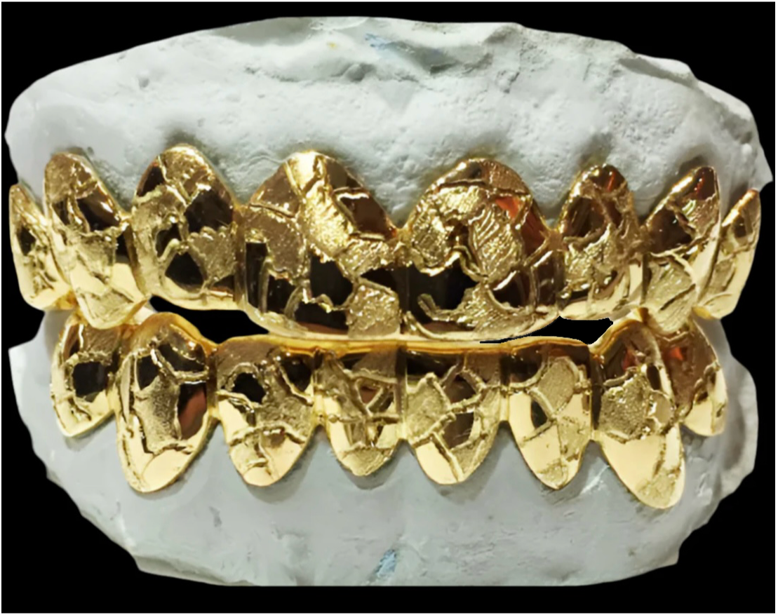 Lava Cut Grillz