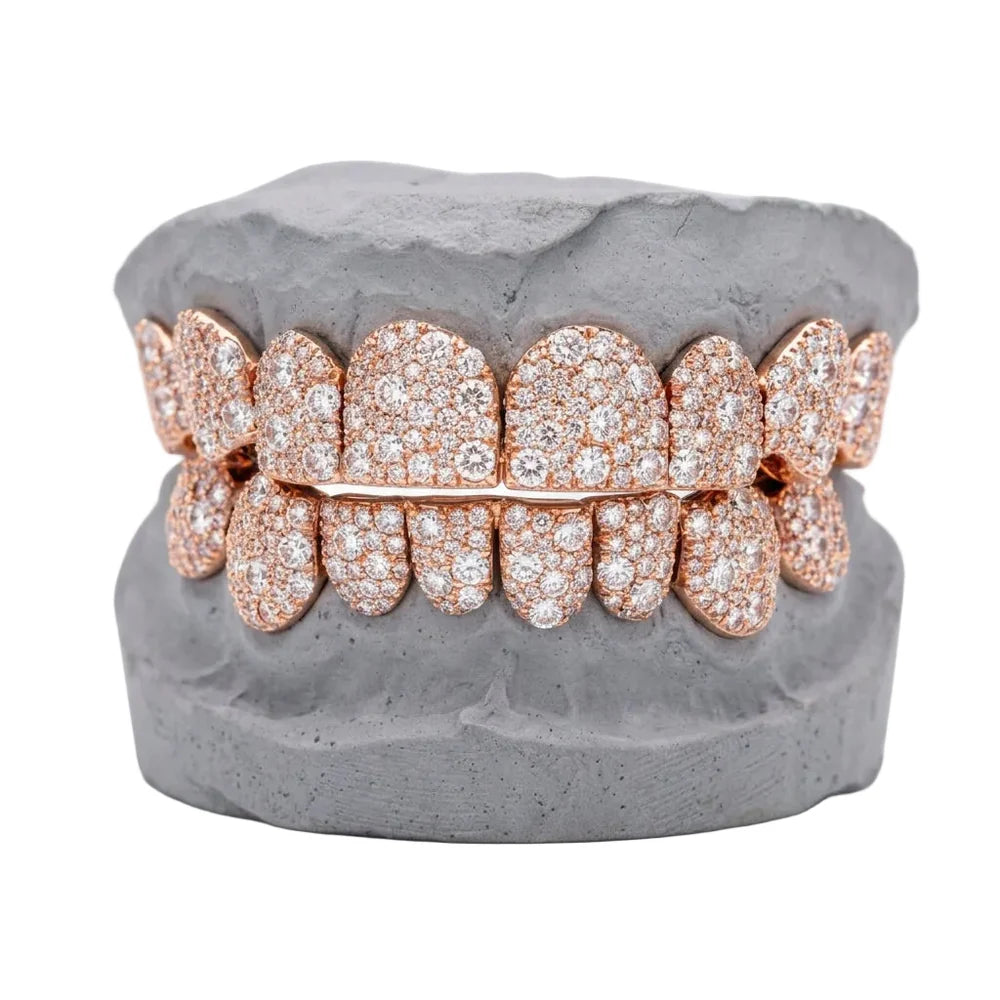 OV Galaxy Grillz