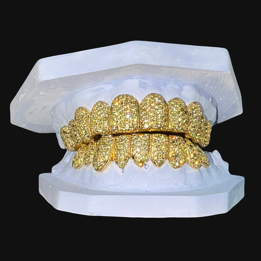 Yellow Canary Zig-Zag Diamond Grillz