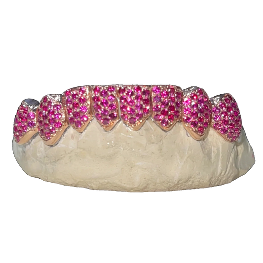 Custom Gemstone Grillz